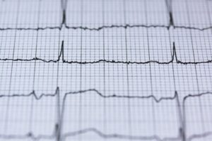 Home Visit Cardiac Rehabilitation in Australia | Guide