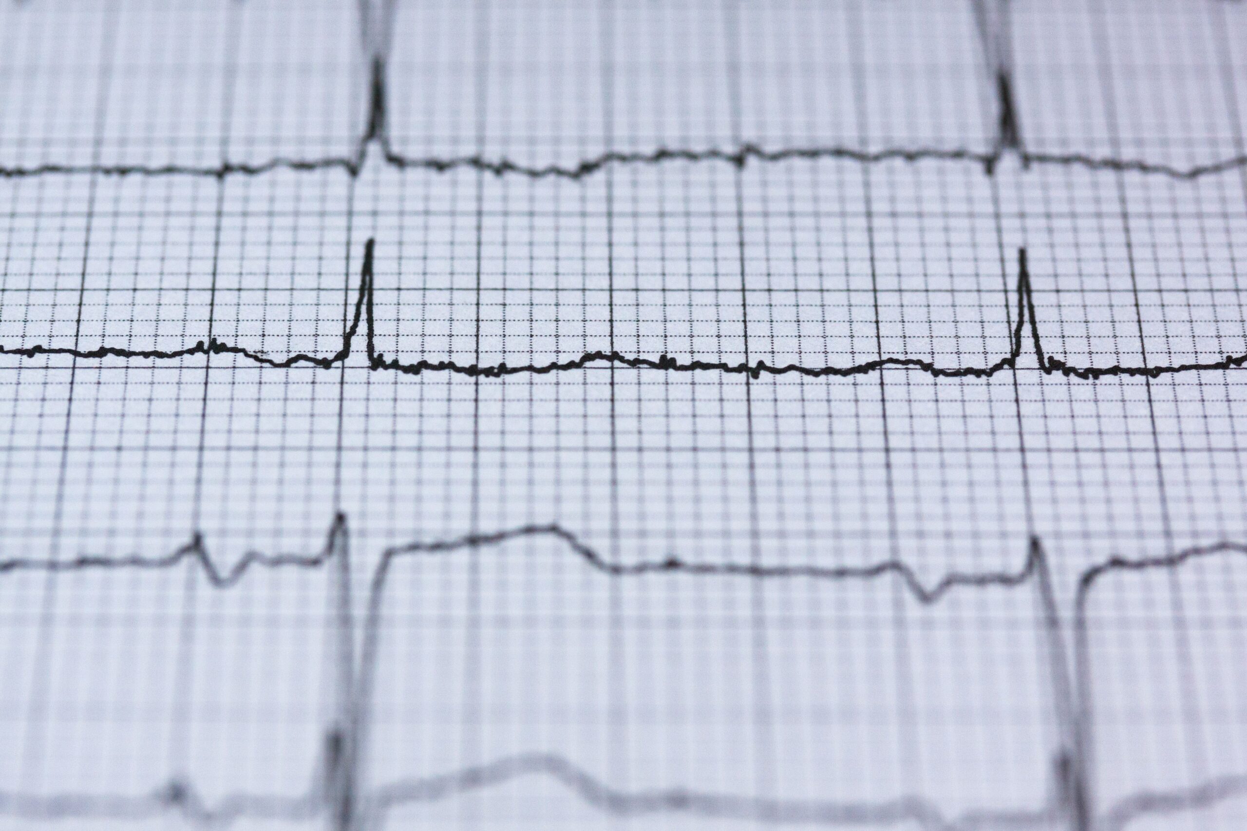 Home Visit Cardiac Rehabilitation in Australia | Guide